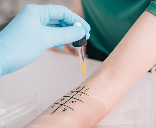 Allergy testing services