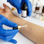 Allergy Testing