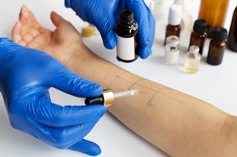 Understanding Allergy Testing: What to Expect and Why It Matters