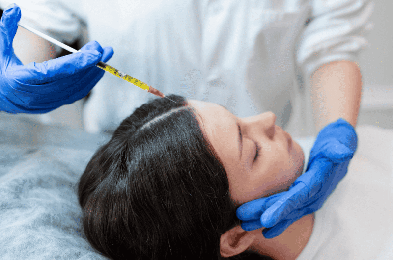Hair Loss PRP Injection: What You Should Know Before Starting Treatment